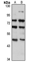 beta 3Gn-T5 Rabbit Polyclonal Antibody