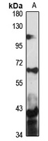 BACE2 Rabbit Polyclonal Antibody