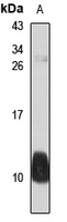 BAGE2 Rabbit Polyclonal Antibody