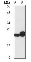 PUMA Antibody