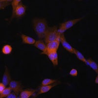 PUMA Antibody