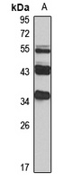BBS4 Rabbit Polyclonal Antibody