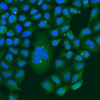 Anti-BBS4 Antibody