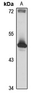 BBS5 Rabbit Polyclonal Antibody