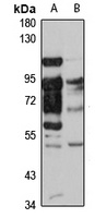 Brevican Rabbit Polyclonal Antibody