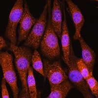 Anti-BCL3 Antibody