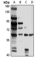 BCDO2 Rabbit Polyclonal Antibody