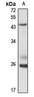 Biglycan Rabbit Polyclonal Antibody