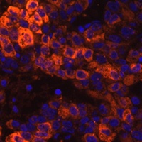 Anti-BHMT Antibody