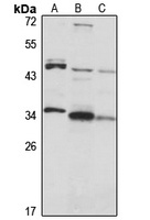 BIN3 Rabbit Polyclonal Antibody