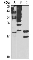 BLOS2 Rabbit Polyclonal Antibody