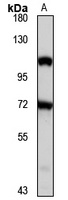 RING3 Rabbit Polyclonal Antibody