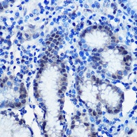 BRD4 Antibody