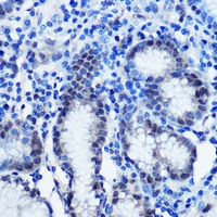 BRD4 antibody