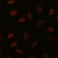 BRD4 Antibody