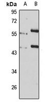 BRF2 Rabbit Polyclonal Antibody