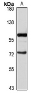 DBC1 Rabbit Polyclonal Antibody
