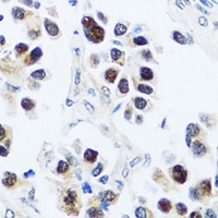 Anti-BXDC2 Antibody