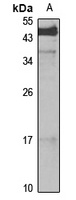 BTG2 Rabbit Polyclonal Antibody