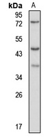 C12orf29 Rabbit Polyclonal Antibody