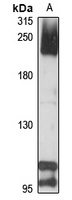 Complement C4-A Rabbit Polyclonal Antibody