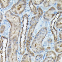 Anti-C9orf72 Antibody