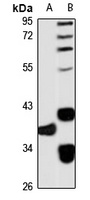 MO25L Rabbit Polyclonal Antibody