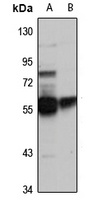 CACNB4 Antibody