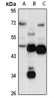 CaMK2 alpha Rabbit Polyclonal Antibody