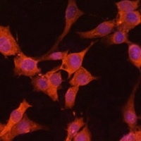CaMK2 alpha Rabbit Polyclonal Antibody
