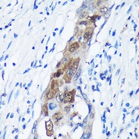 Anti-CaMKK alpha Antibody
