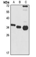 CAML Rabbit Polyclonal Antibody