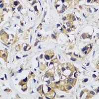 CAML Rabbit Polyclonal Antibody
