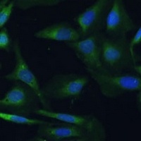 CAML Rabbit Polyclonal Antibody
