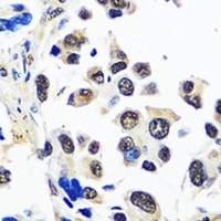 Anti-TIP120A Antibody