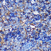 TIP120B Antibody