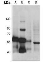 CAP1 Rabbit Polyclonal Antibody