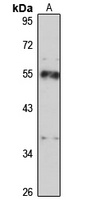 CAP2 Rabbit Polyclonal Antibody