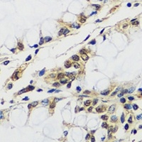 CASC5 antibody