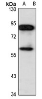 CBFA2T3 Antibody