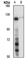 c-CBL Rabbit Polyclonal Antibody