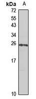 HP1 beta Rabbit Polyclonal Antibody
