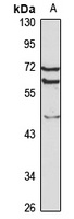 CBX6 Antibody