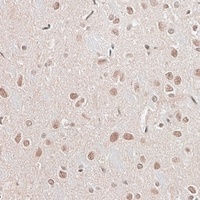 Anti-CBX6 Antibody