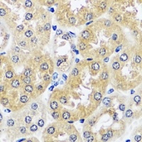 Anti-CCDC124 Antibody