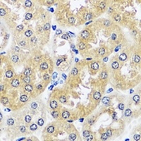 CCDC124 antibody