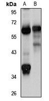 CCDC47 Antibody
