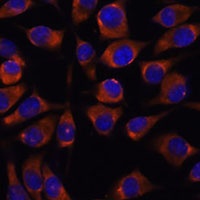 CCDC47 Antibody