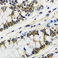 Anti-CCDC59 Antibody