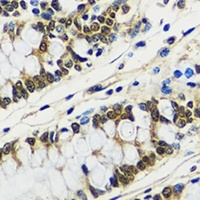 CCDC59 antibody